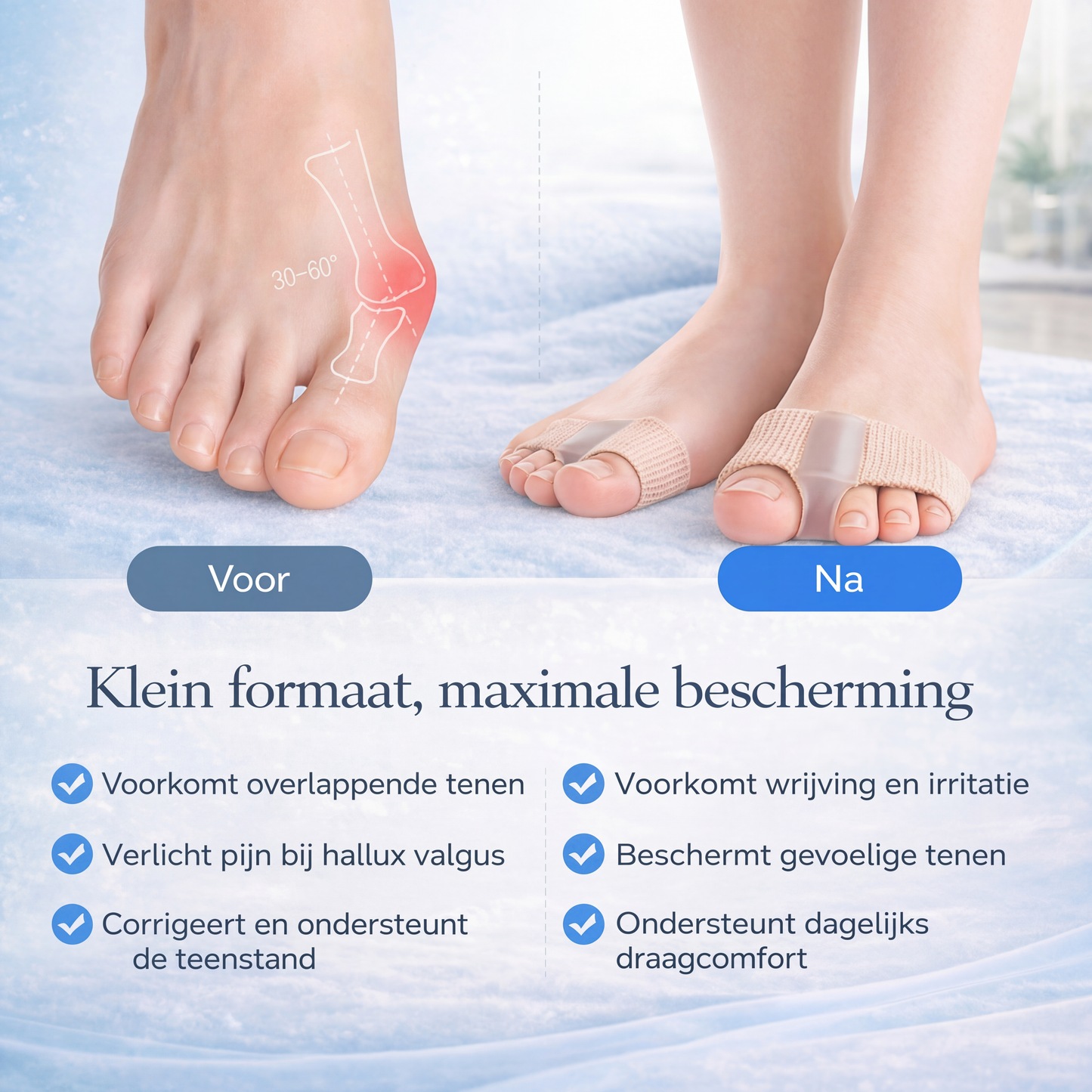 BelleToe – Voor perfecte tenen in slippers & open schoenen