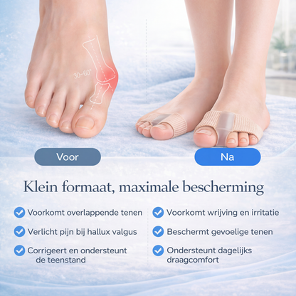 BelleToe – Voor perfecte tenen in slippers & open schoenen